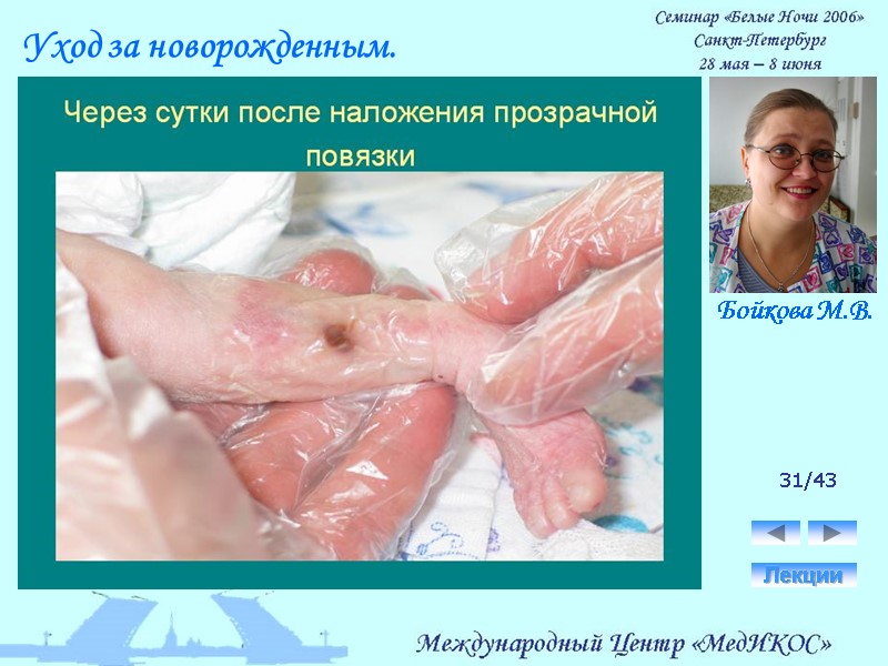 31/43 Лекции Уход за новорожденным. Бойкова М.В.